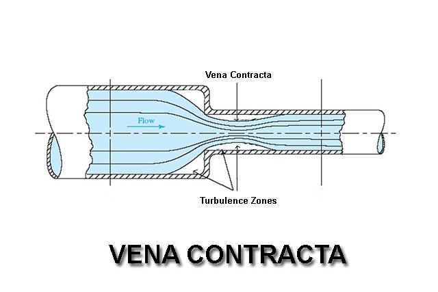 Vena Contracta